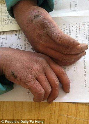 berjalan 4.5km dalam cuaca sejuk, rambut budak ni jadi beku bila sampai sekolah