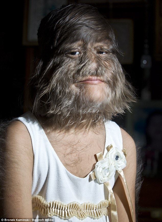 gadis ‘chewbacca’ cukur bulu di muka pertama kali lepas jatuh cinta