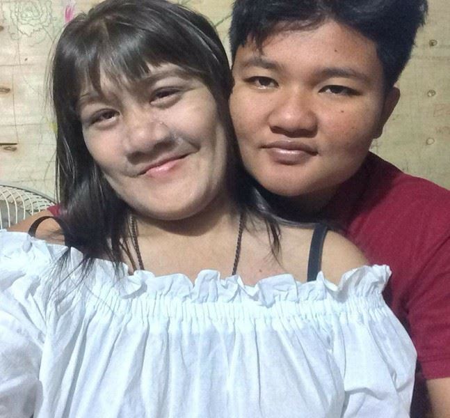 gadis ‘chewbacca’ cukur bulu di muka pertama kali lepas jatuh cinta