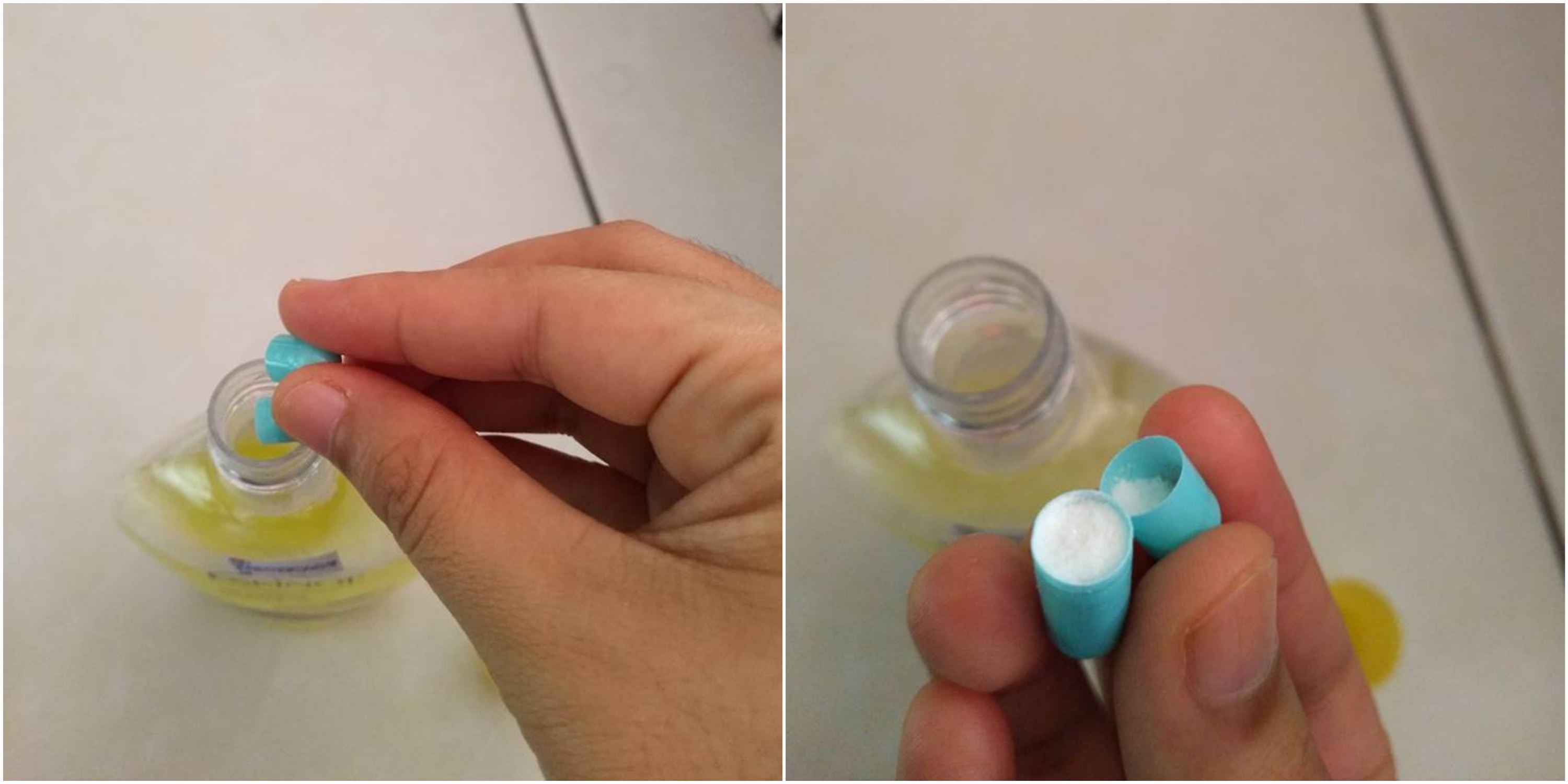 cara hilangkan jerawat batu guna eskinol lemon dan anti bakteria jadi viral