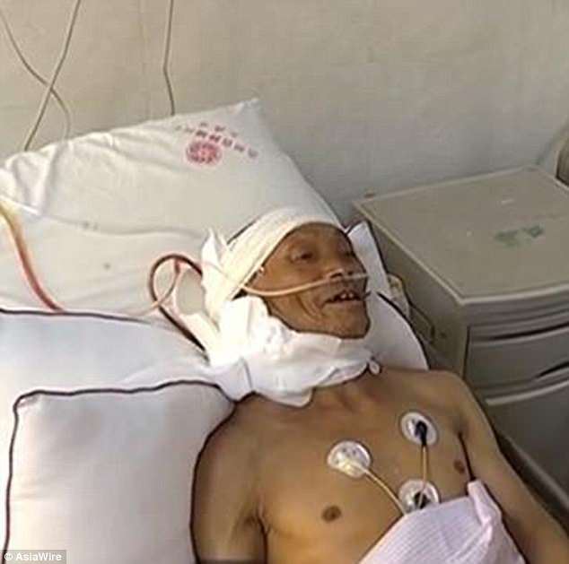 47 tahun lelaki ini bawa ‘beban’ di belakang leher