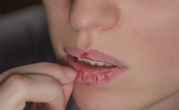 5 tabiat bibir kering tanpa sedar
