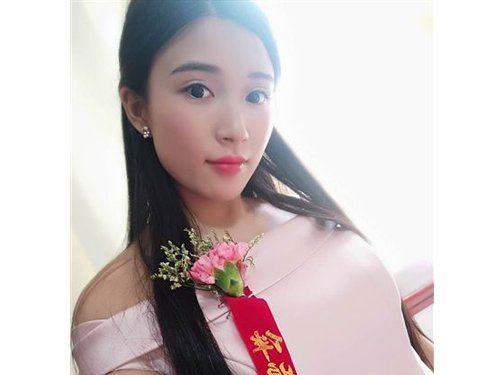 2 hari jadi bridesmaid, kaki wanita ni kena potong