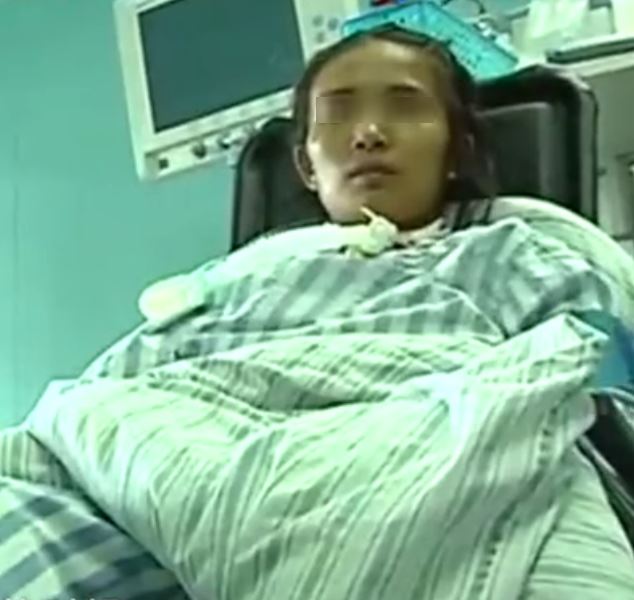 2 hari jadi bridesmaid, kaki wanita ni kena potong