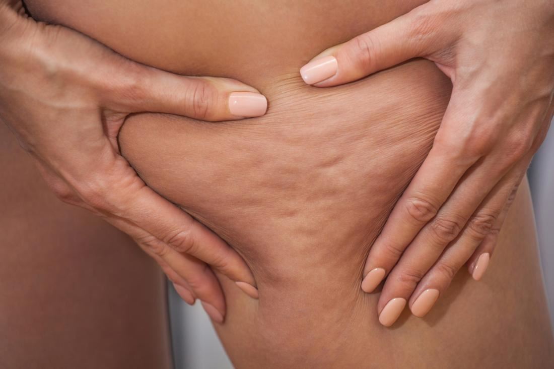 bantu dapat pinggul bulat, ini 8 kebaikkan squat untuk wanita