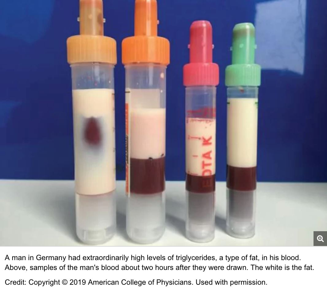 lelaki banyak sangat lemak hingga buatkan darahnya jadi warna putih