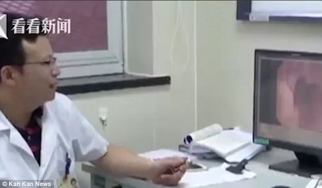 berpuluh-puluh gigi tumbuh di salur tekak jadi punca sukar bernafas