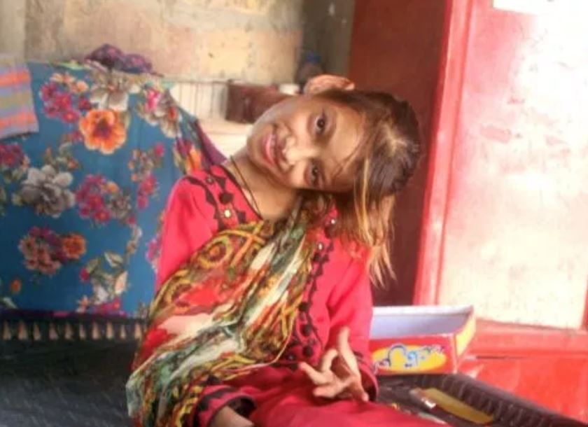 kanak-kanak ini hidup dengan kepala bongkok 90 darjah