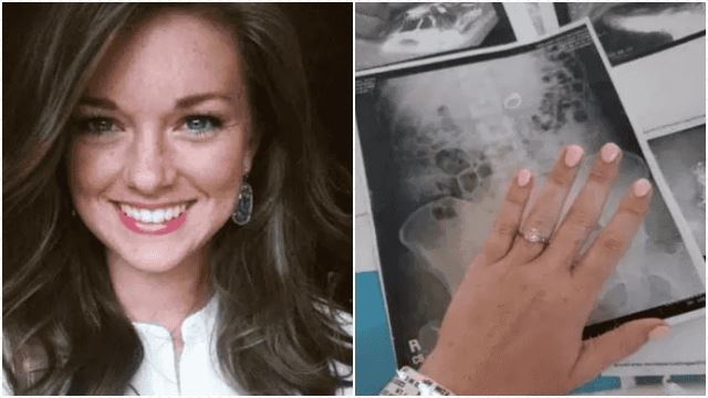 takut sebab mimpi orang jahat, wanita ini tertelan cincin tunang masa tidur