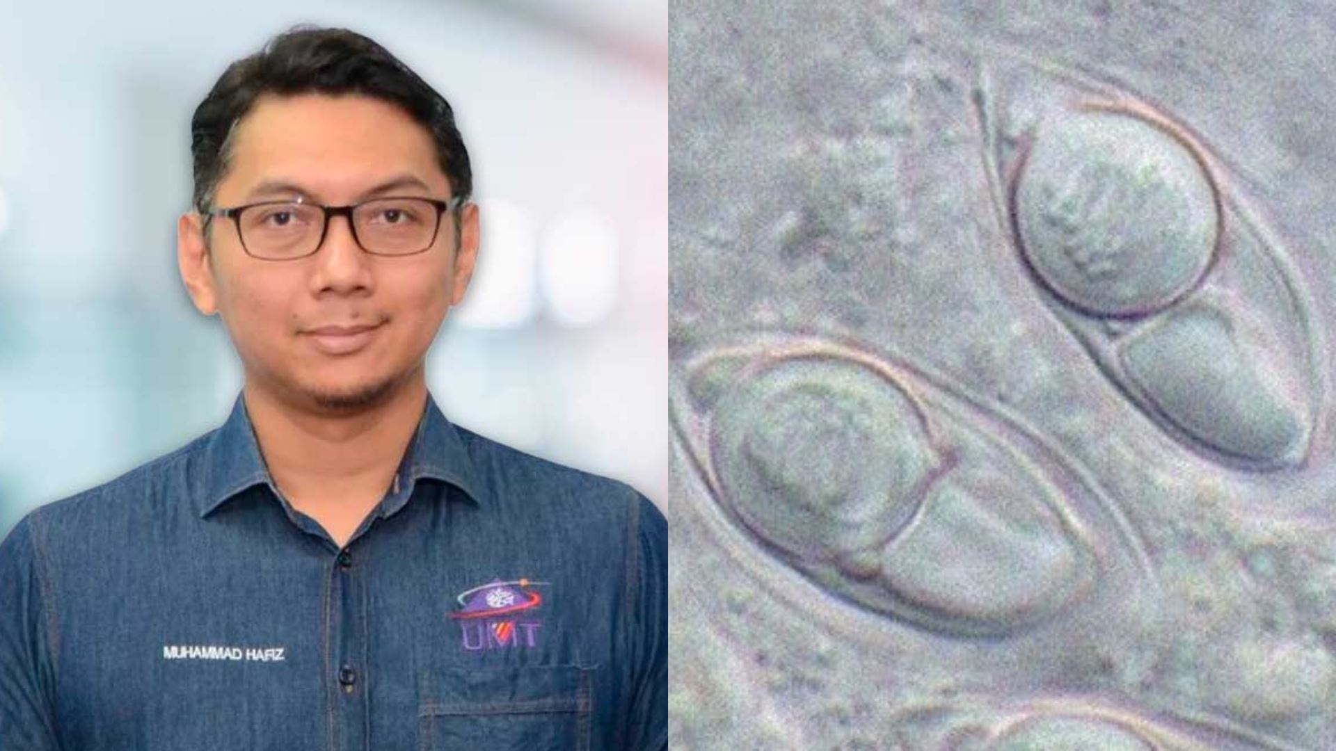 Nama Pensyarah UMT Diabadikan Pada Spesies Parasit Ikan Baharu, Thelohanellus Borkhanuddini Raih Pengiktirafan Global