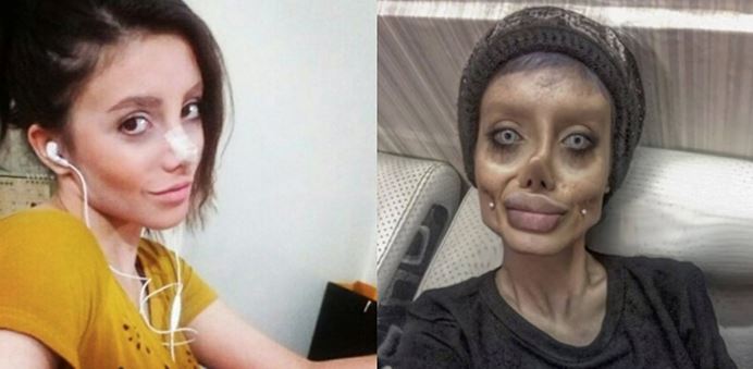 obses nak tiru wajah artis, wanita ini buat pembedahan hingga wajahnya bertukar seram!