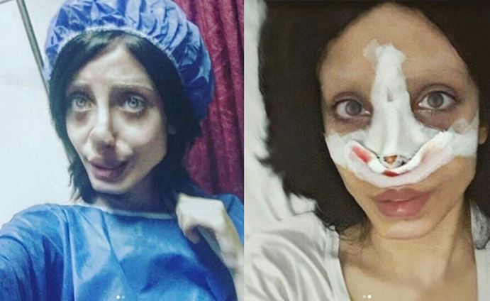 obses nak tiru wajah artis, wanita ini buat pembedahan hingga wajahnya bertukar seram!