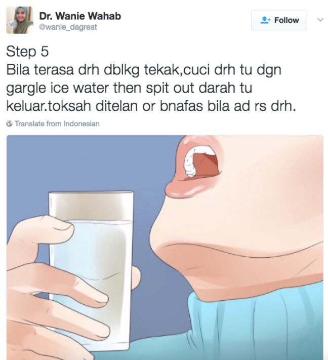 jangan mendongak bila hidung berdarah ! cara betul adalah dengan melakukan 7 step ini