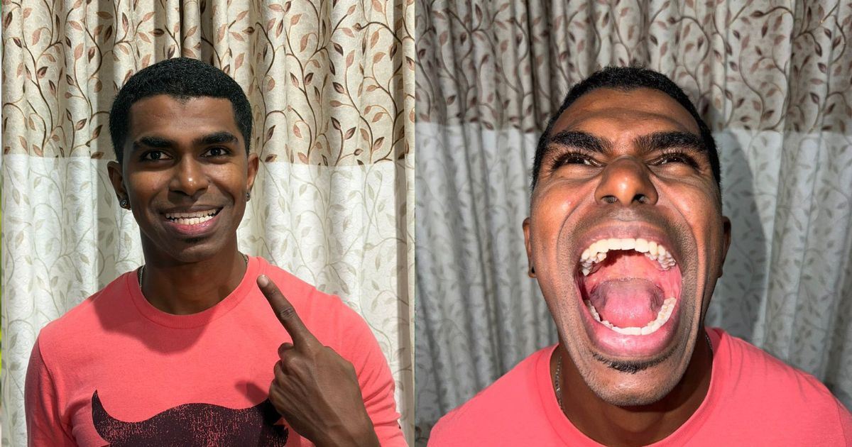 Luar Biasa! Lelaki Malaysia Jadi Pemegang Rekod Dunia Dengan 42 Batang Gigi Dalam Mulut
