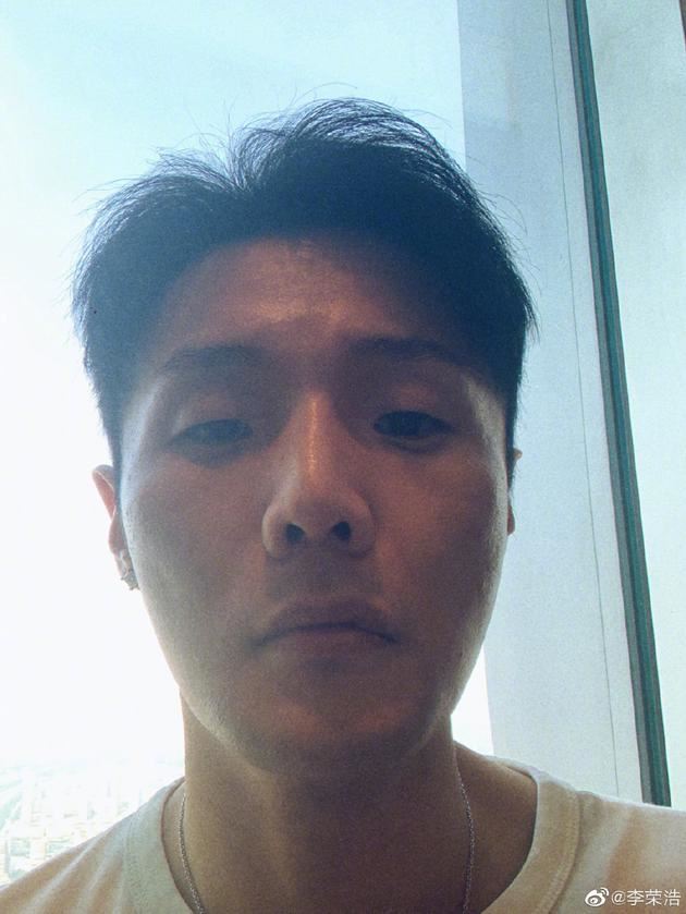 李荣浩嘴上异状凸起:十几年前车祸留疤所致