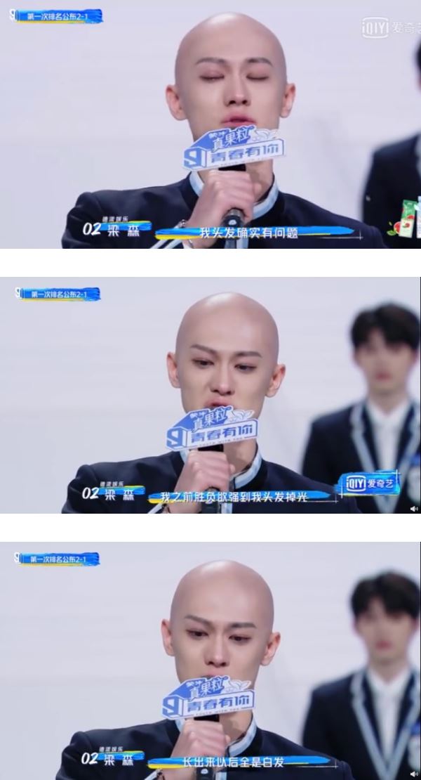 梁森公开光头的原因！压力头发掉光！长满白发..
