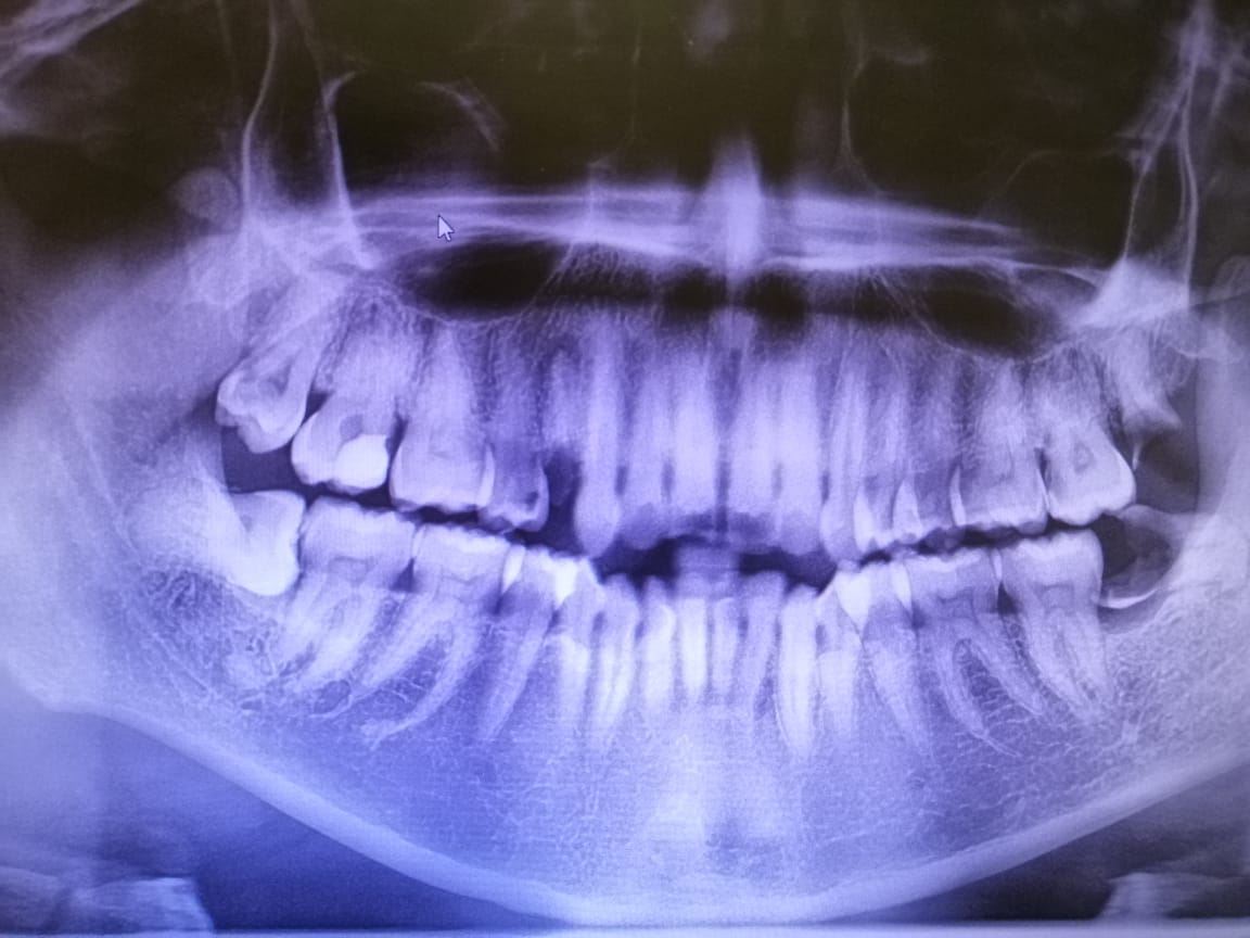 spm毕业生分享【牙医护士】打工经历🦷