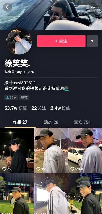 培永有双胞胎弟弟？和中国抖音男神撞脸！白版黑皮！都帅！