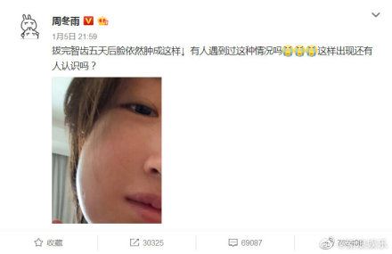 李现「好奇宝宝」上线！现场问周冬雨：”两边都拔了吗“😂😂