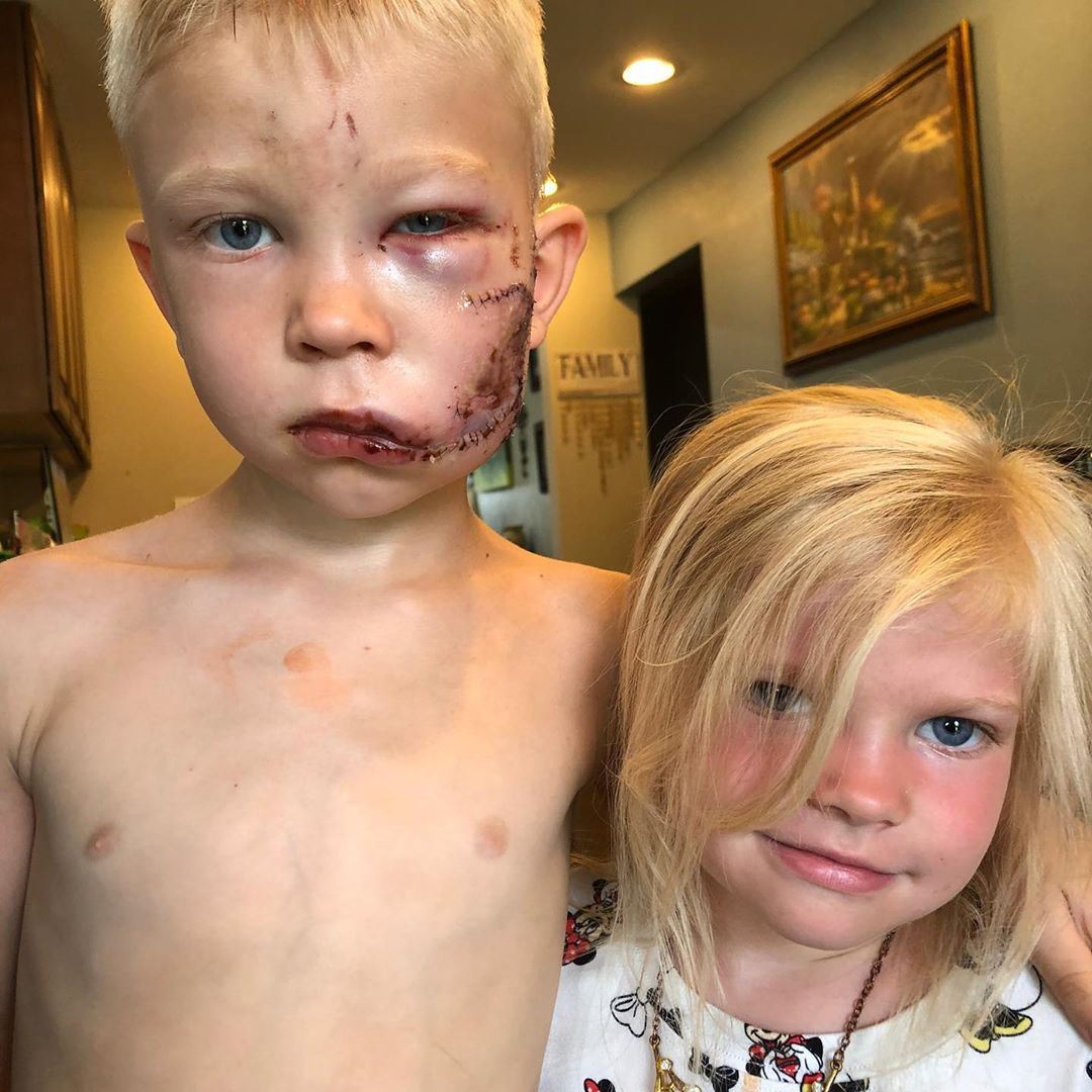 robert downey jr. and tom holland surprises boy that protected sister from dog attack