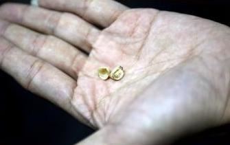 man breaks two teeth after biting into stone in his tasty bun