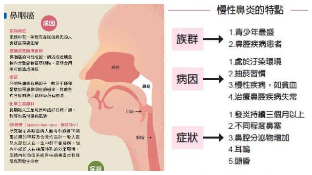 什么是鼻咽癌？鼻咽癌常见的症状有哪些？