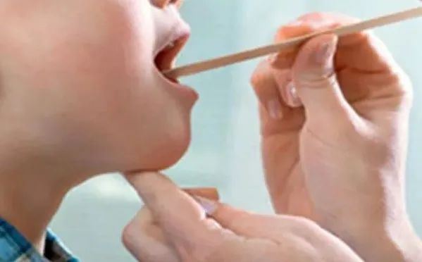 猛咳半年!舌头整片黄 医生诊断肺癌末期