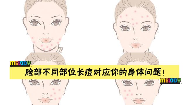 怎么办? 下巴位置长痘＝荷尔蒙分泌失调？ 