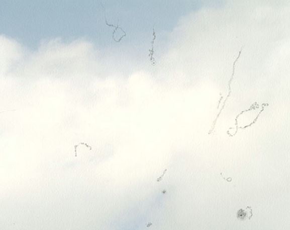 眼前总看见有蚊子在飞舞？你或患上了飞蚊症！