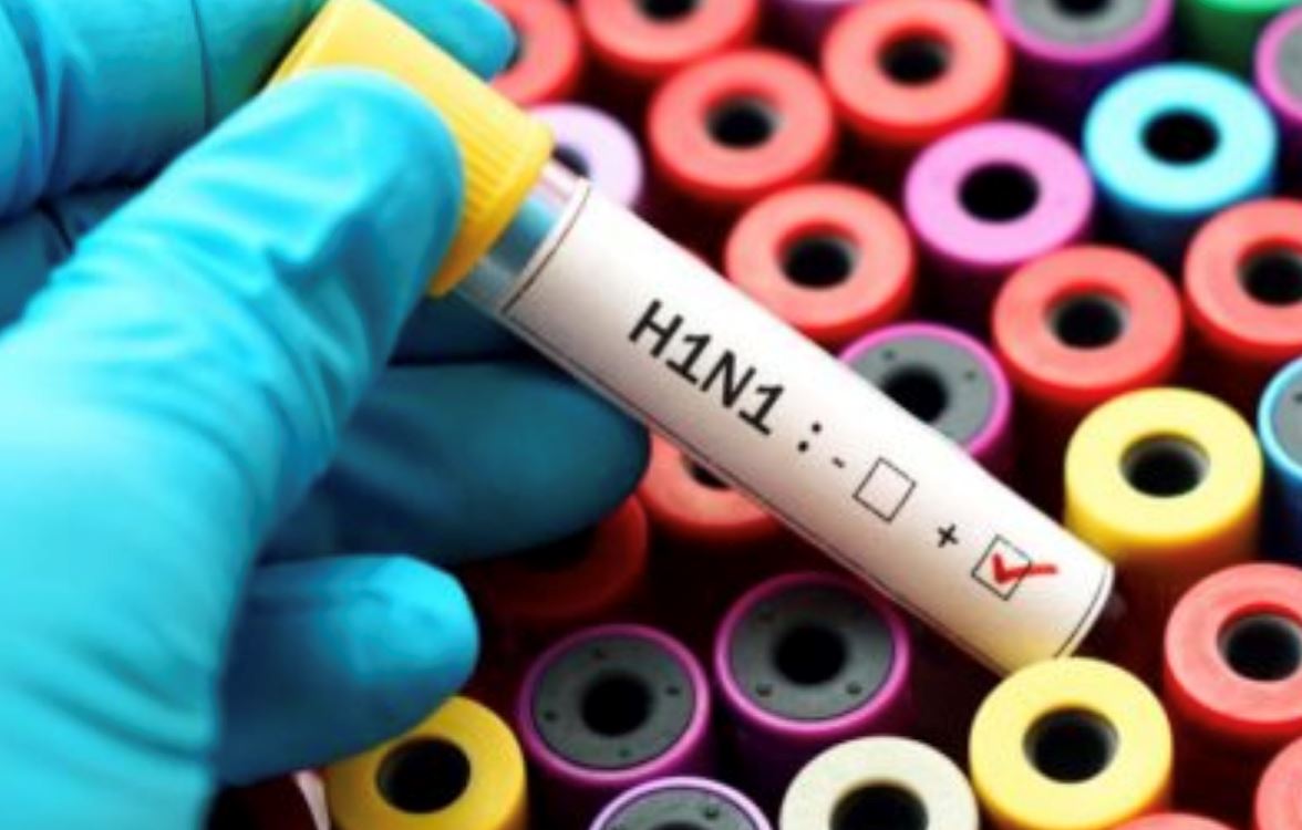 79师生集体感染h1n1！附上h1n1的症状和如何做好预防措施！