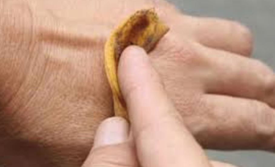 吃完香蕉别把香蕉皮扔掉! 香蕉皮有哪些作用呢？