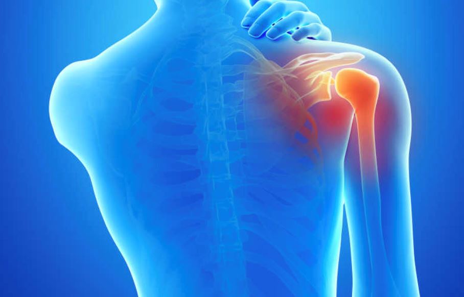 你肩膀痛吗?姿势不良人的肩关节容易受伤?