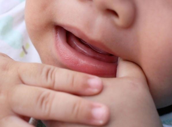 fda:停售!幼儿长牙止痛凝胶可致命!