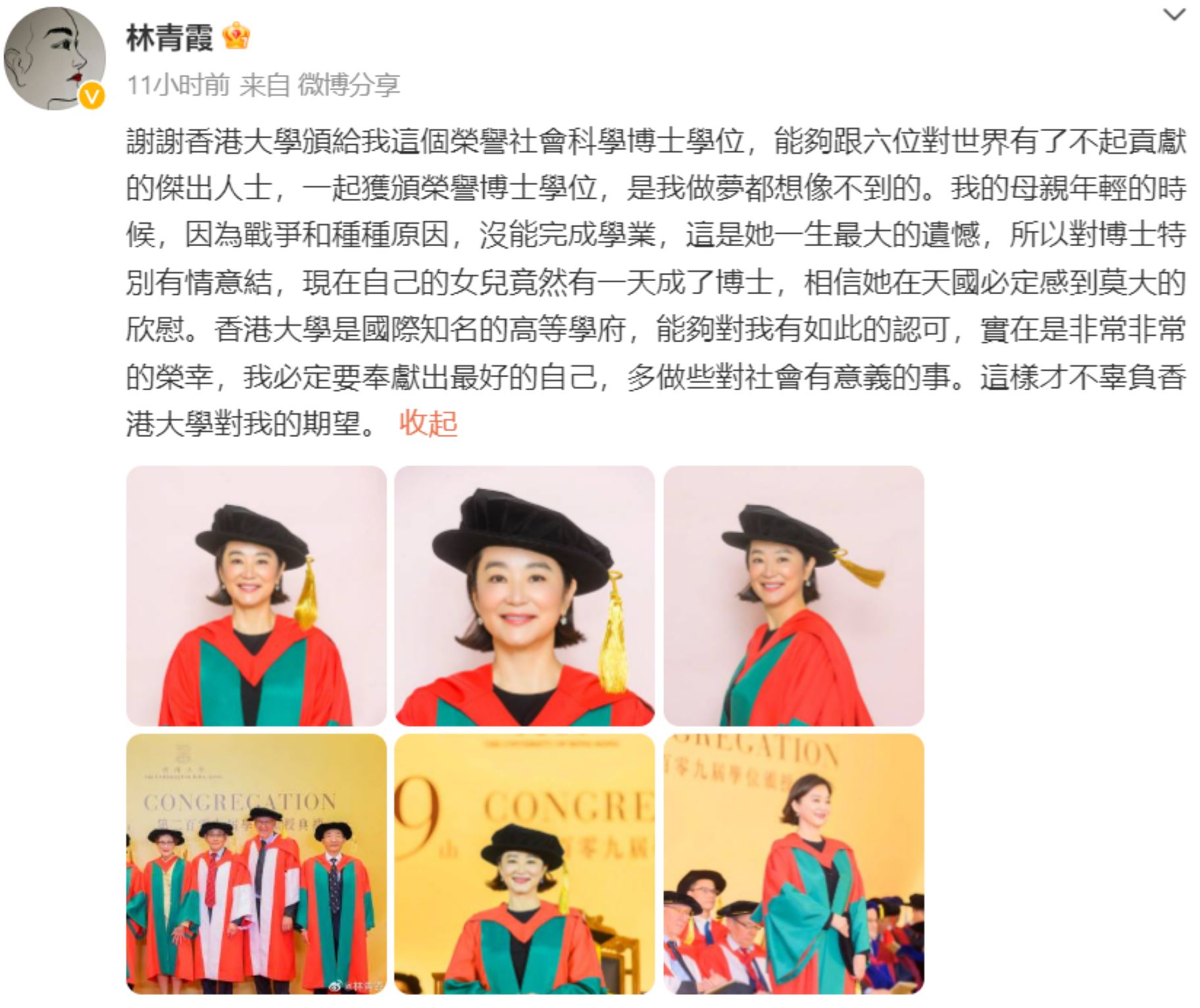 林青霞获颁港大荣誉博士！ 