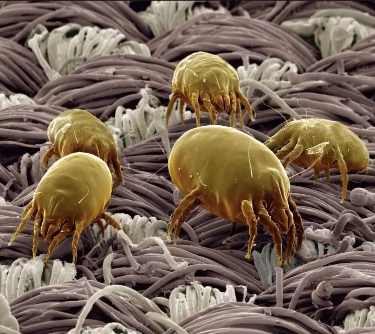 你的床单放着很久没洗了?床单5大病菌危害健康! | melody