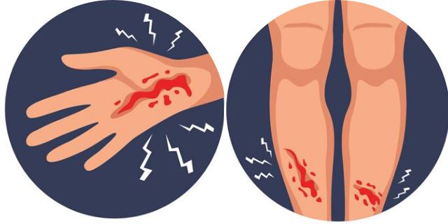 5 common emergencies that can happen at home, and how you should react