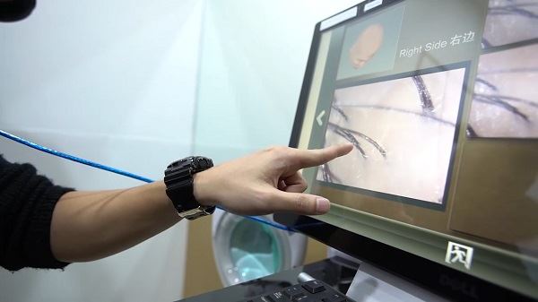 头发是男人的魂     阿晨告诉你男人的头皮也需要护理！