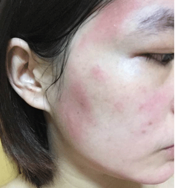 12点后才睡觉「直毁7部位」 专家:补眠再久都难弥补