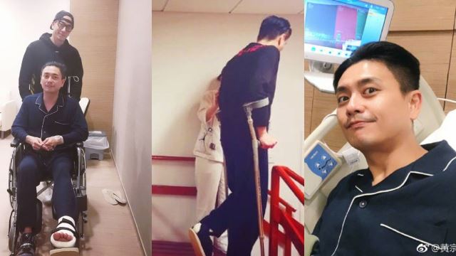 急做手术镶钢钉！黄宗泽拍新剧夹伤脚掌骨碎