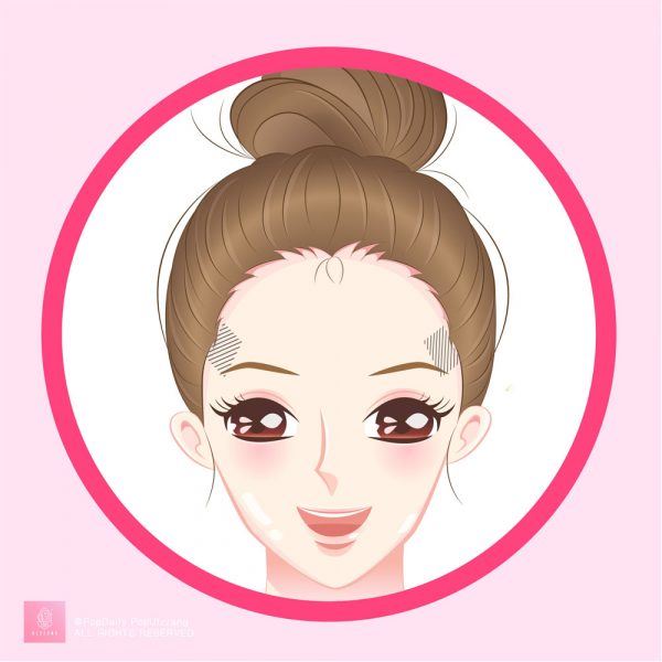 无缘无故冒痘?长痘9个位置看出身体警讯!
