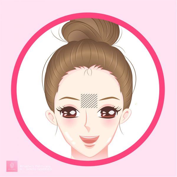 无缘无故冒痘?长痘9个位置看出身体警讯!