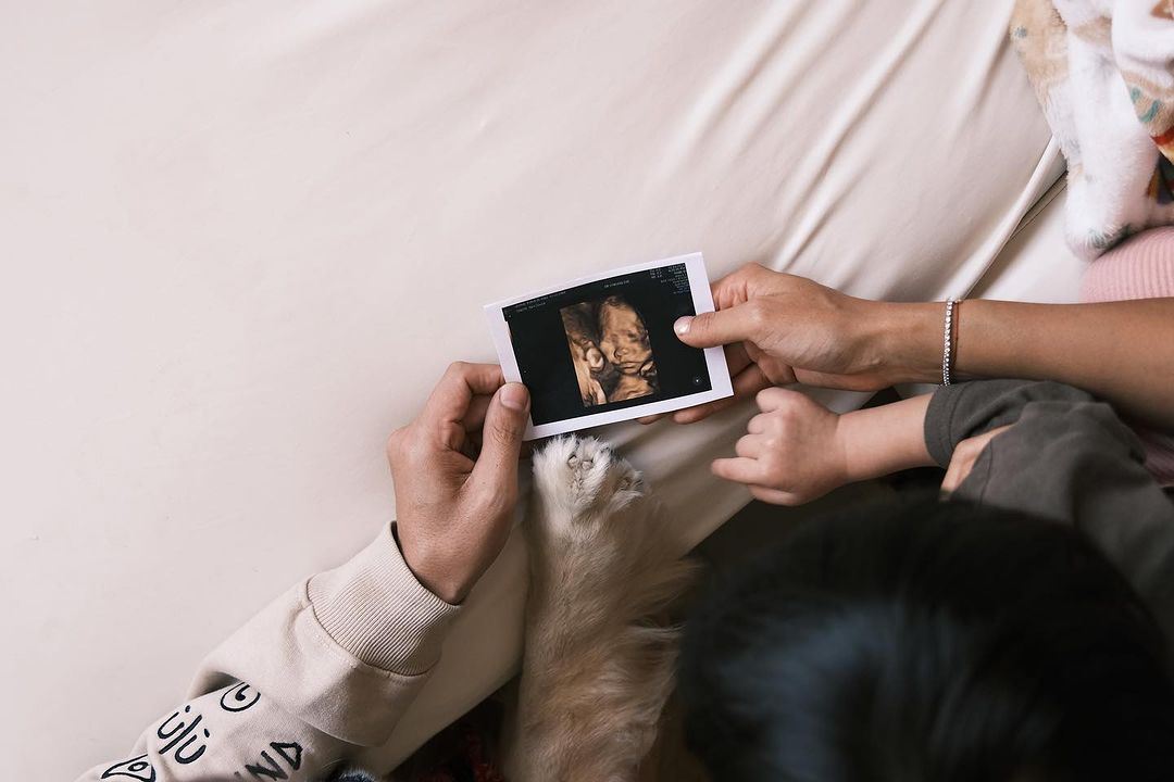 洪永城晒二胎b超❗太太梁诺妍预产期在2024年4月🔥