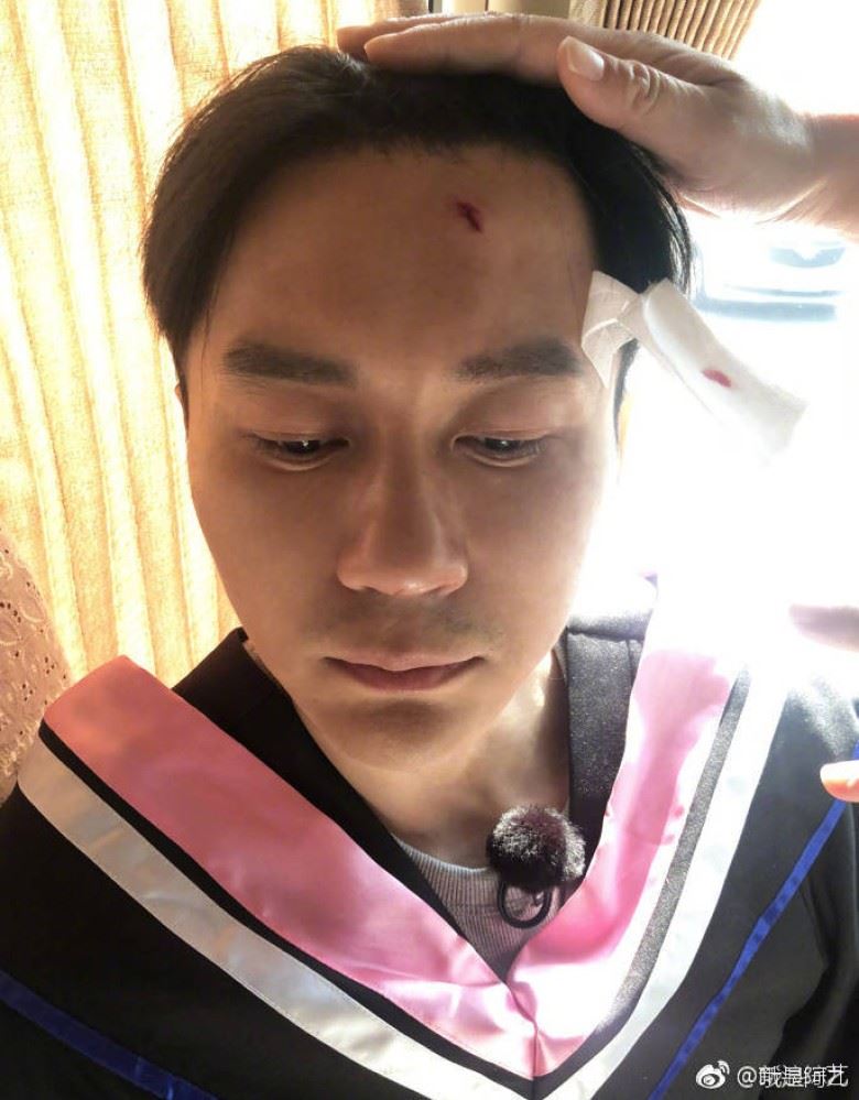 《奔跑吧》录制现场发生意外！李晨被砸伤！额头出血