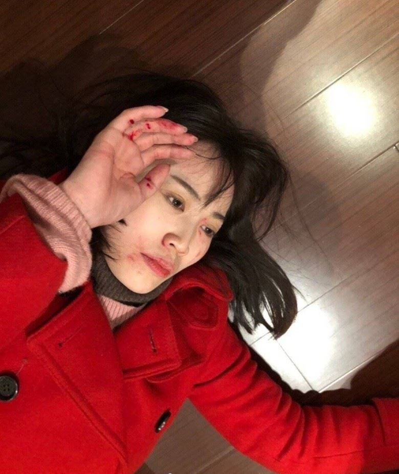 受伤照疯传！马蓉自称被王宝强打