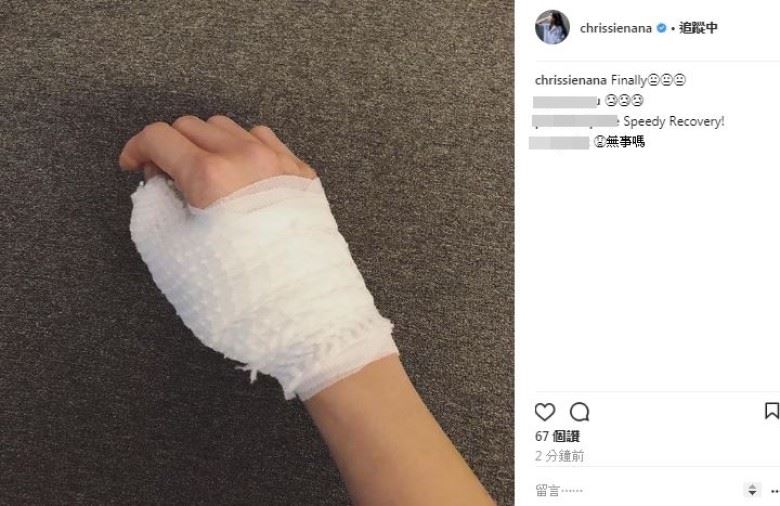 纯熙受伤了？！周秀娜上载包扎照片！网友：胡定欣最开心