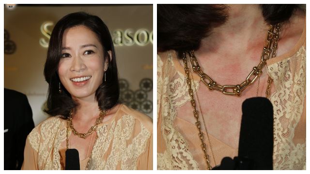 怎么了？！娴妃佘诗曼胸口有一片红印