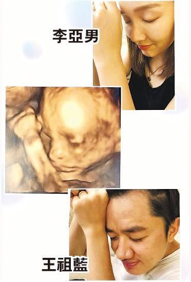 王祖蓝晒女儿超声波照片！网友：跟王祖蓝好像啊