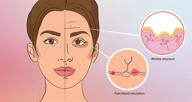 do i really need to wear sunscreen every day?