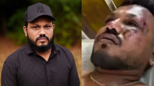 "Tuhan Beri Nyawa, Tapi Ambil Segala Bahagia” - Luahan Mangsa Tunggal Terselamat Nahas Air India