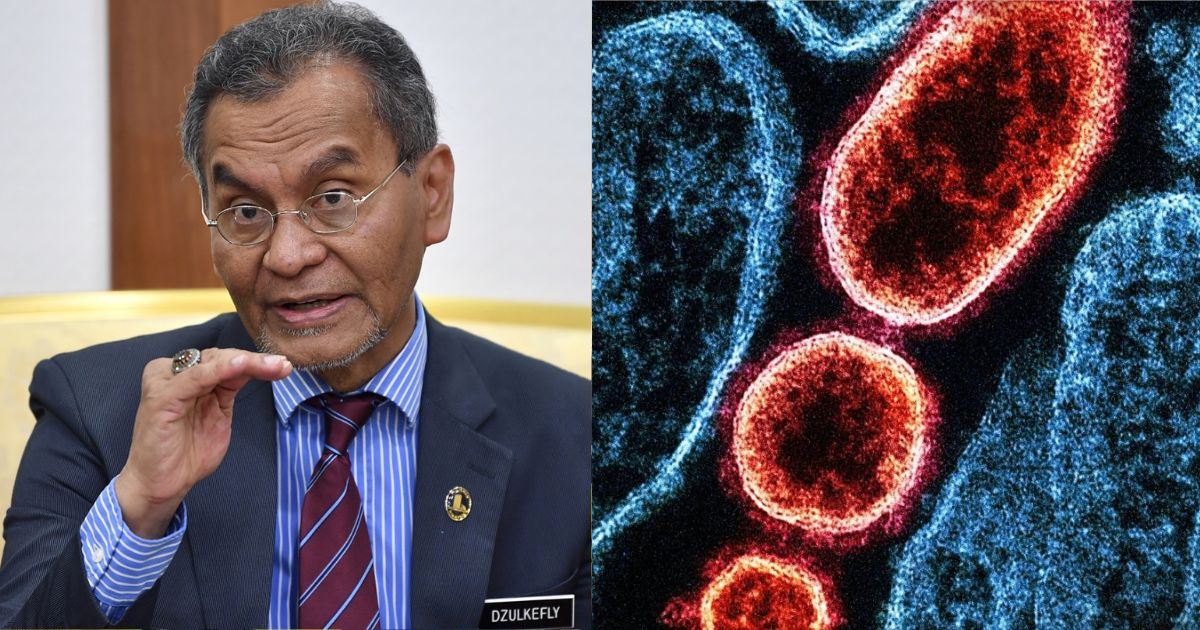 KKM Keluarkan Amaran: Malaysia Tingkat Kesiapsiagaan Hadapi Ancaman Virus Nipah